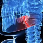 Dental Emergencies